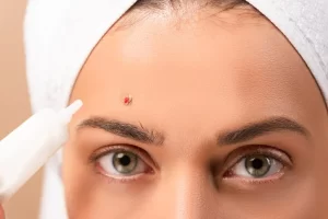 5 unusual causes of inflammation